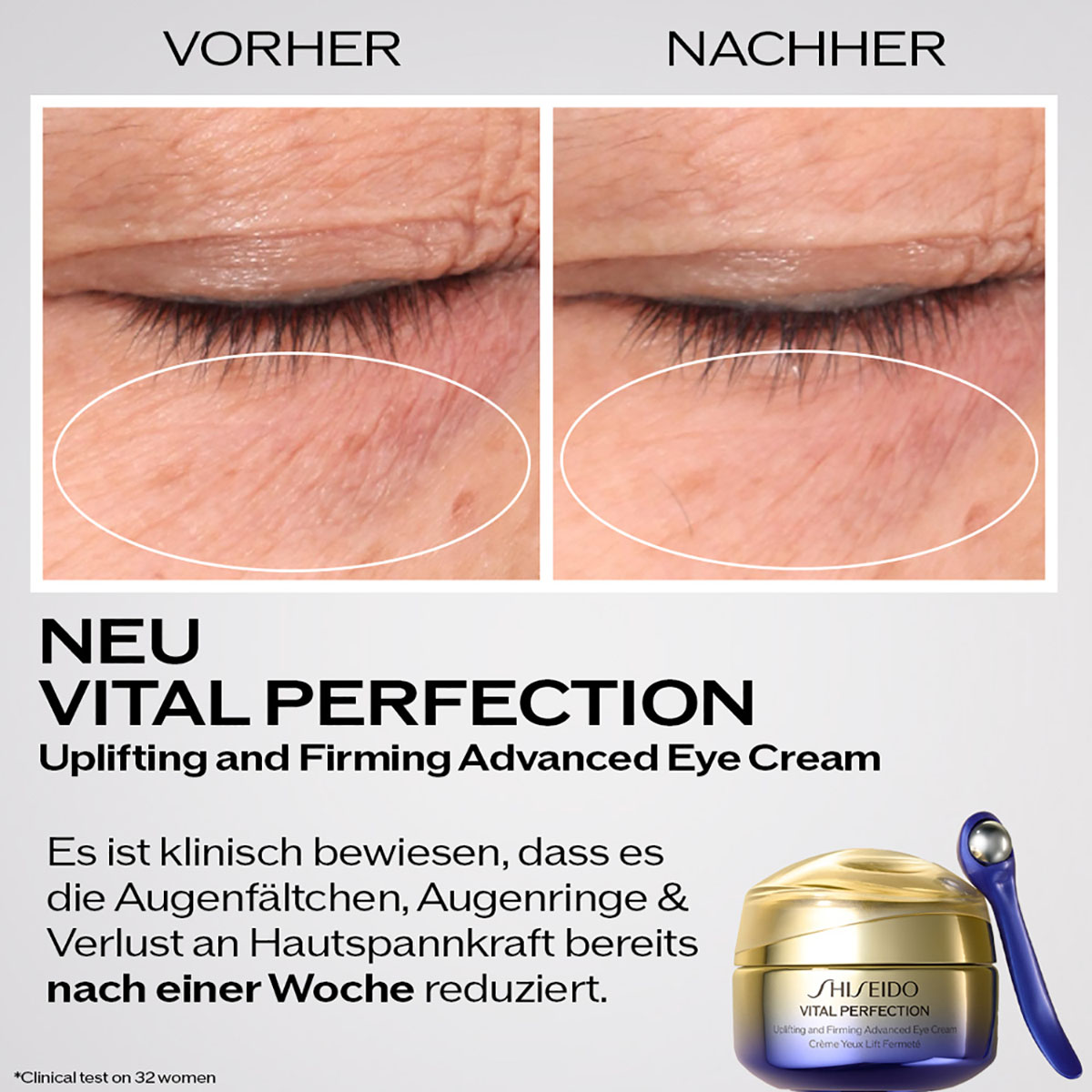 Shiseido Vital Perfection Uplifting and Firming Eye Cream 15ml