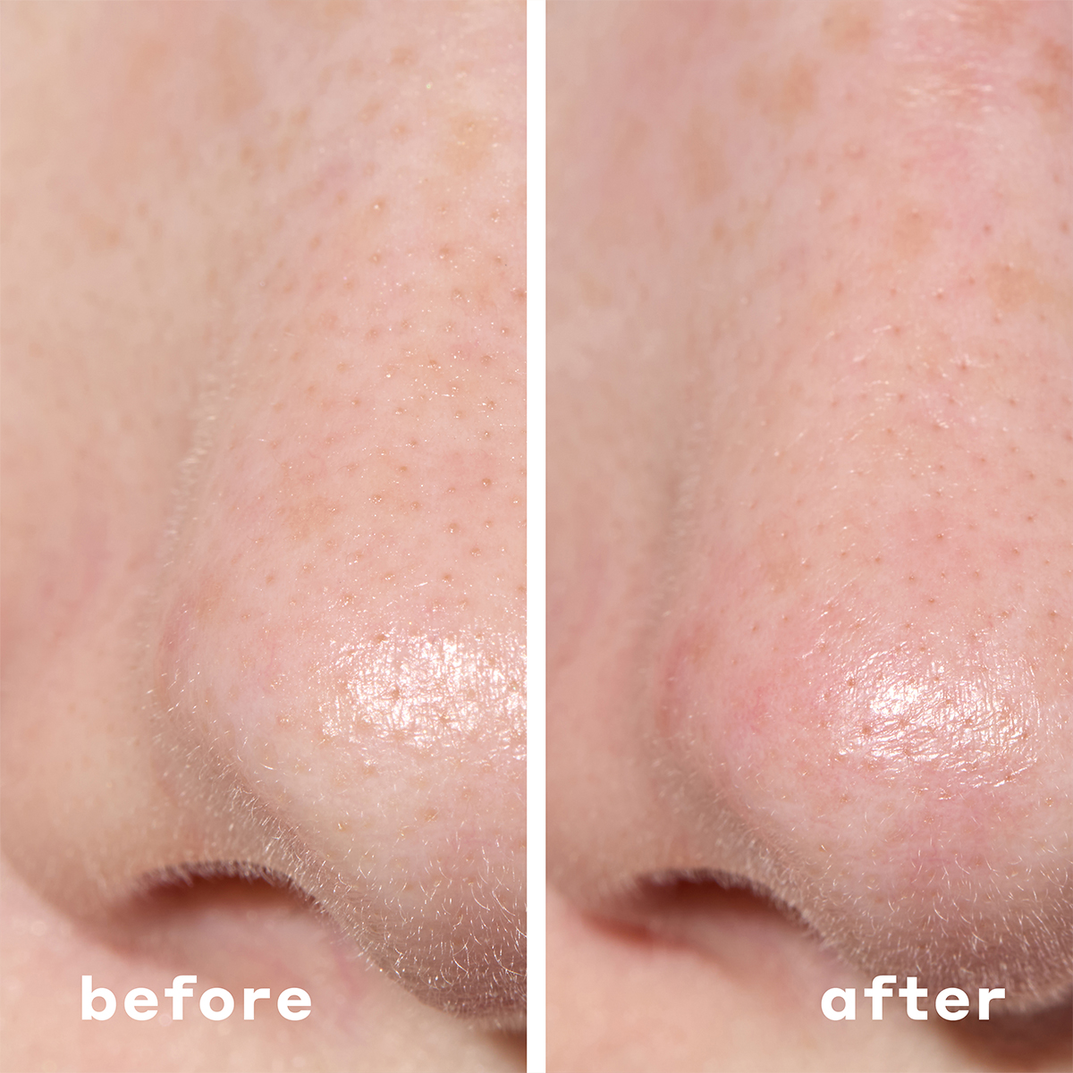 Mario Badescu 2-In-1 Deep Cleansing Pore Strip 6 Stück