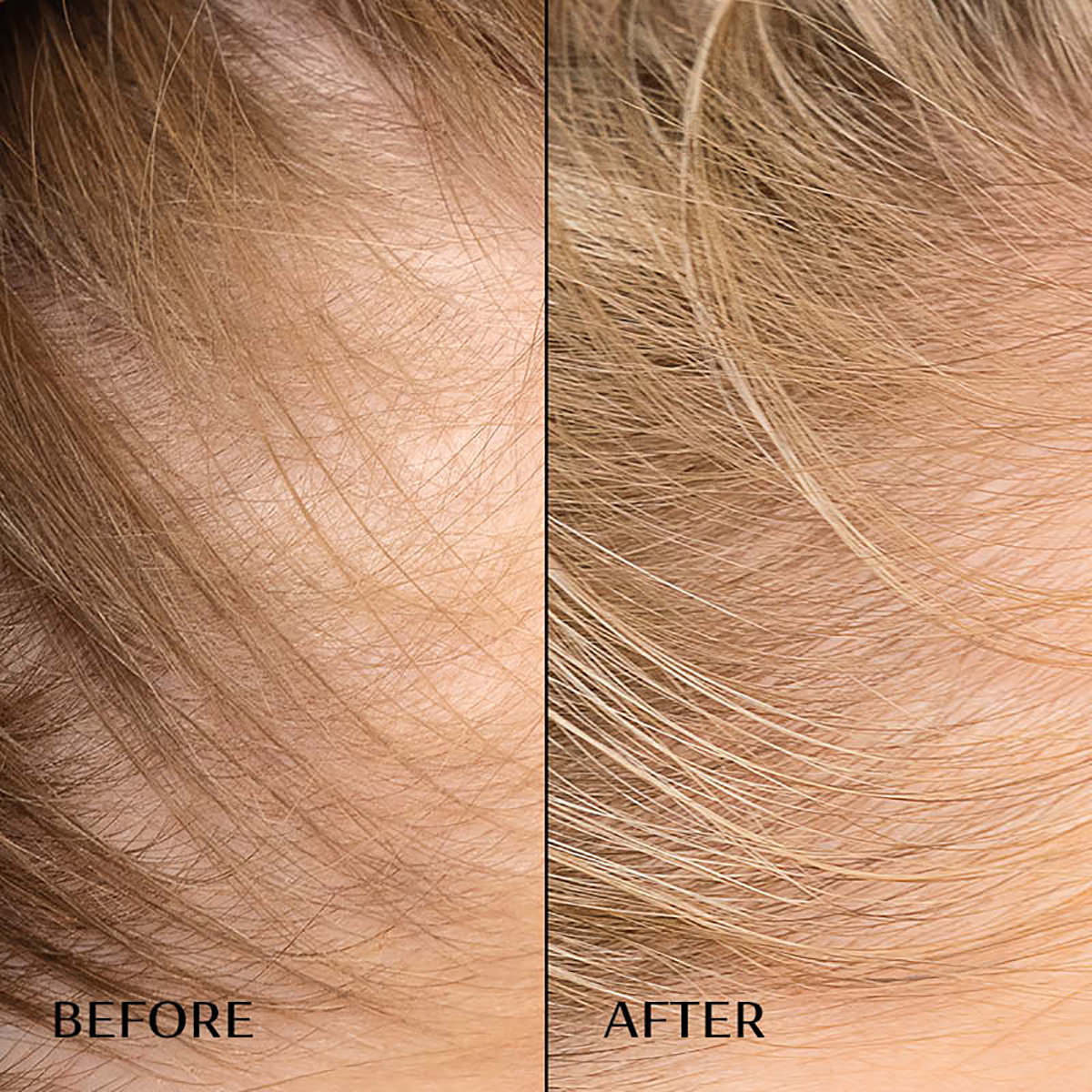 M2Beauté Hair Activating Serum 120ml
